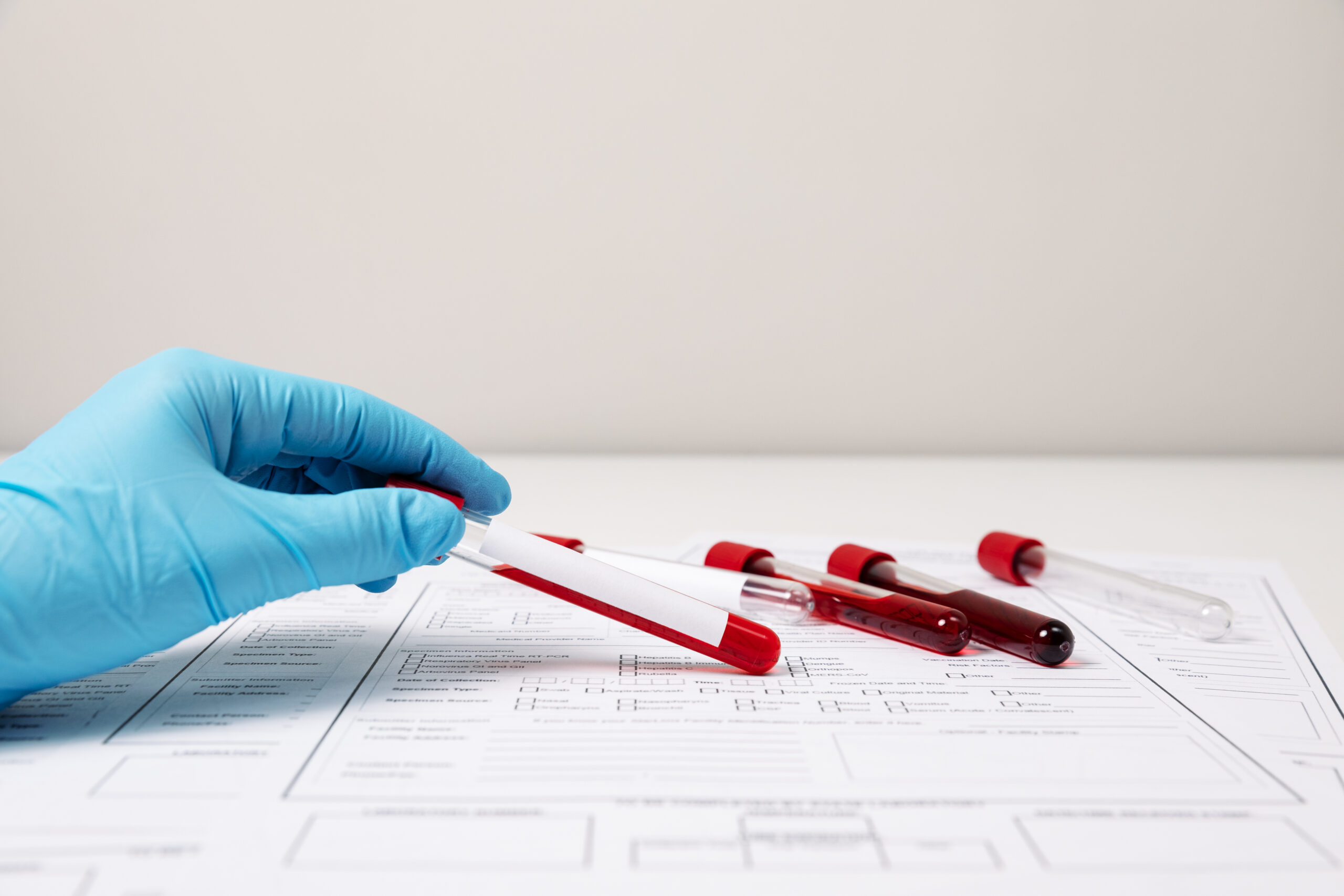 In-House Blood Drawing in Cape Coral